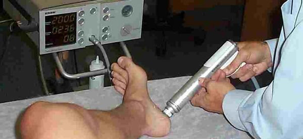 Plantar Fasciitis Treatment